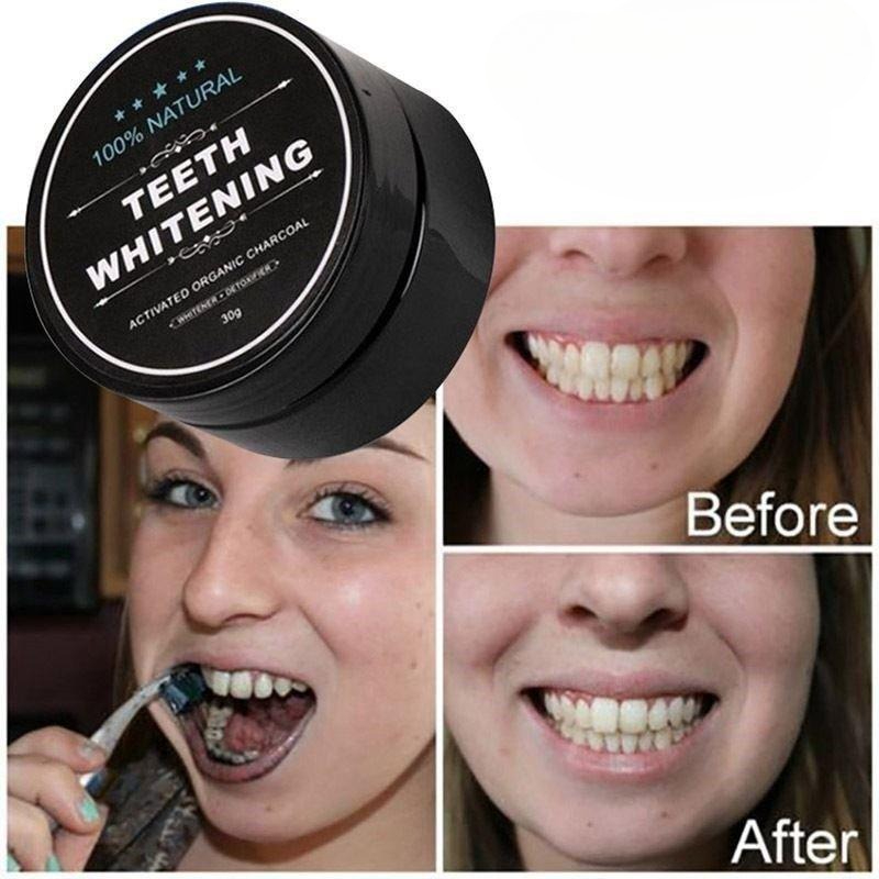 1 Box Aktivkohle-Zahnaufhellun – Activated Charcoal Powder Bewertung und Preis